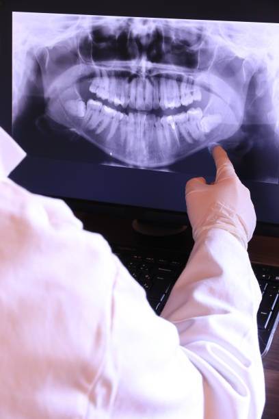 Best Emergency Root Canal Treatment in Old Stine, CA